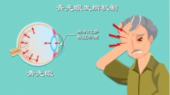 世界青光眼日|宁波博视眼科俞存:青光